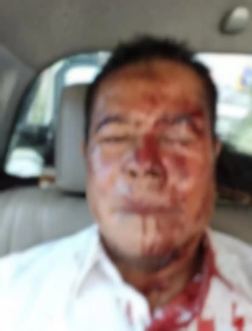 Penjabat Gubernur Papua, Ridwan Rumasukun yang ikut arak-arakan menjadi korban (Foto: Istimewa)