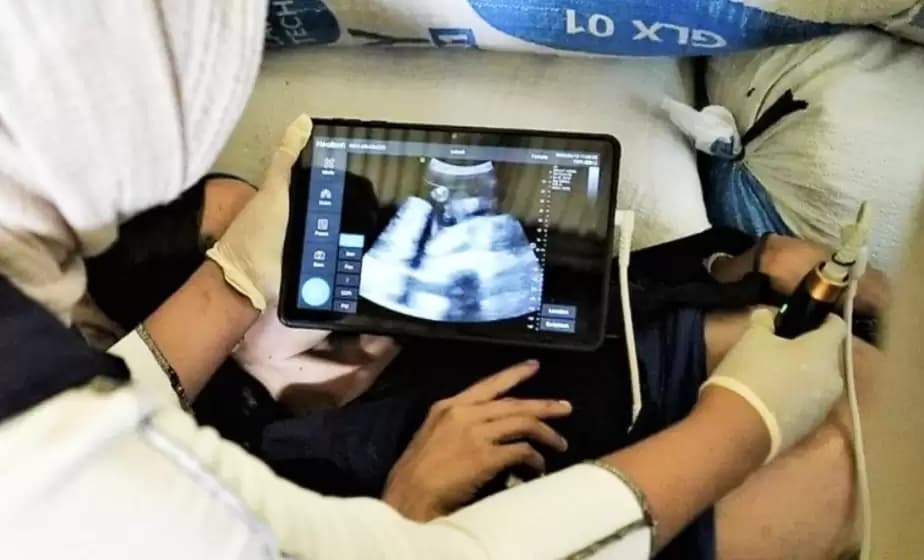 Beberapa Hal yang Harus Dipersiapkan Ibu Hamil saat Ingin Mudik