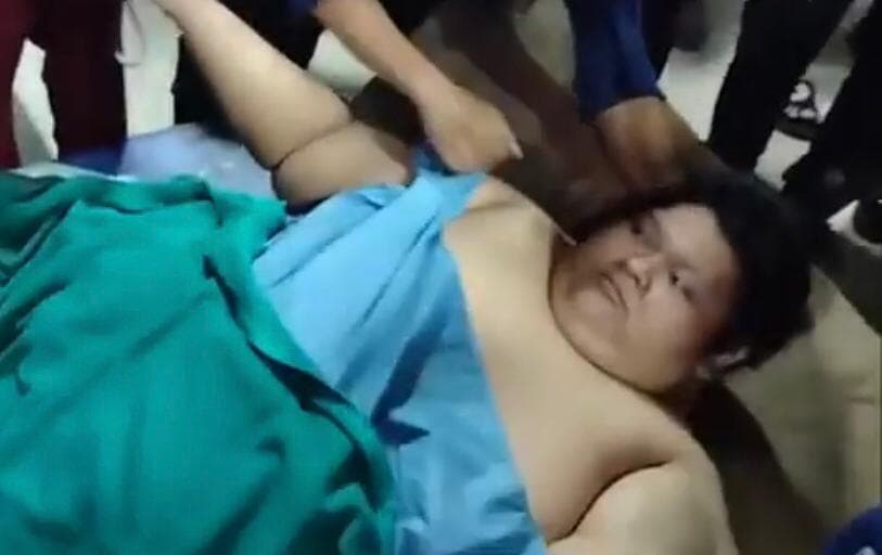 Fajri Pria Obesitas 300 Kg Meninggal Dunia di RSCM