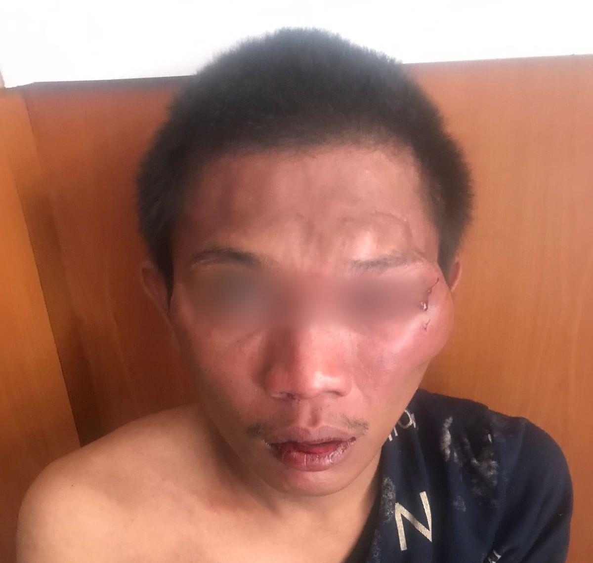 Pencuri Sepeda Motor Babak Belur Diamuk Warga