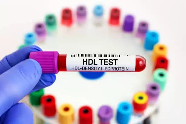 Cara Meningkatkan Kolesterol Baik dalam Tubuh
