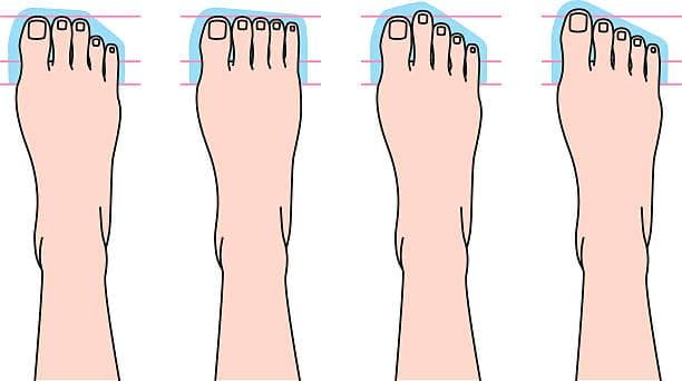 Bentuk Jari Kaki Bisa Ungkap Kepribadian Seseorang, Kamu yang Mana?