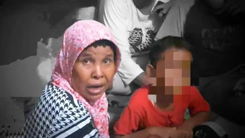 Dokter Duga Fenomena Bocah di Jakut 'Disunat Jin' Adalah Parafimosis