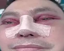 Ujang Iskandar seperti baru saja melakukan operasi wajah di Kota Ho Chi Minh, Vietnam (Foto: Dok MI/kaltengpedia)