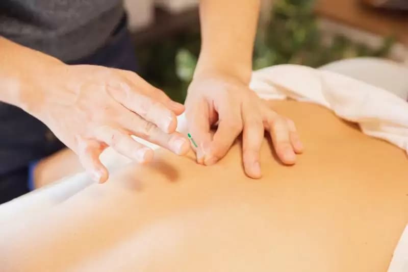 Akupuntur Bisa Jadi Pilihan Terapi Stroke