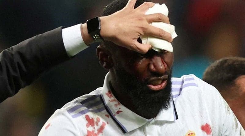 Ancelotti: Rudiger Mengalami Pukulan Berat Dibagian Otot