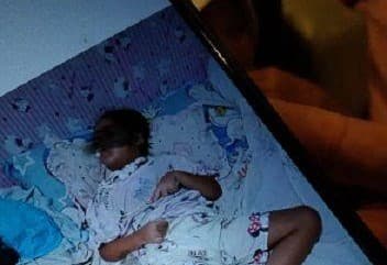 Pemerintah Santuni Korban Gagal Ginjal Akut Rp 50 Juta/Nyawa