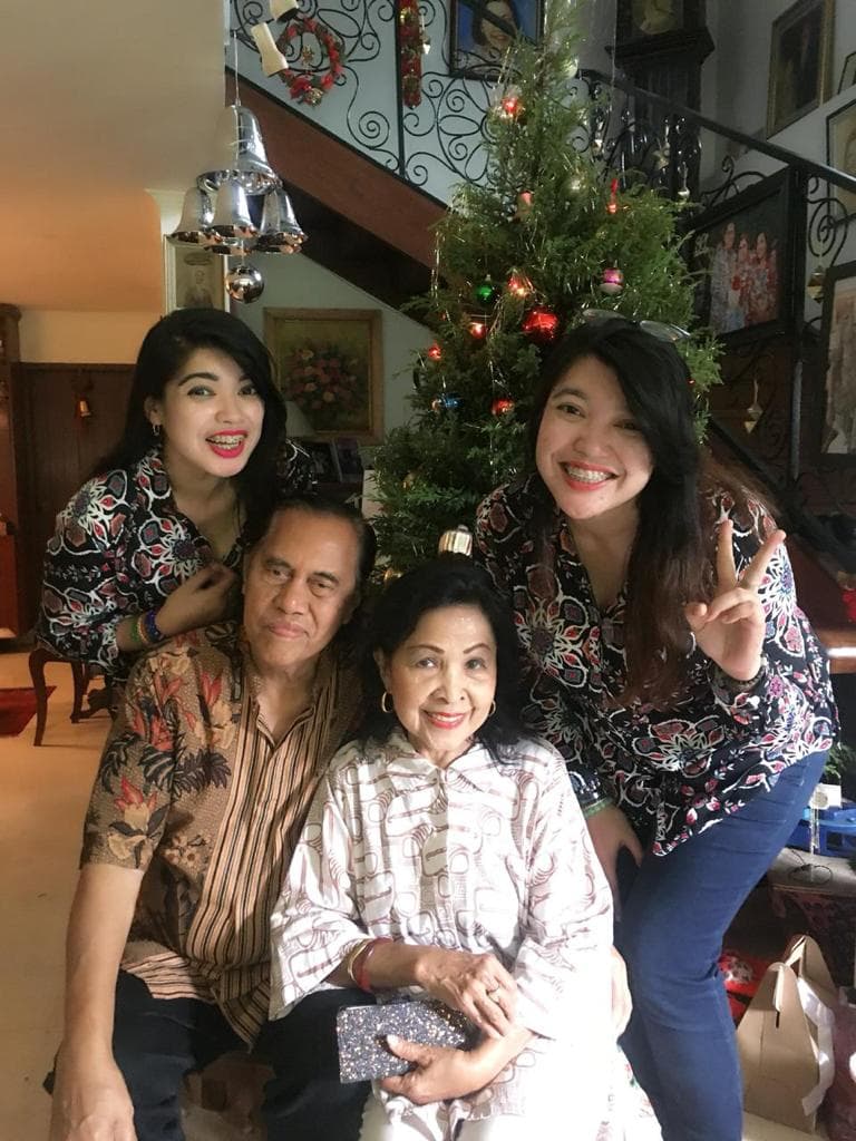 Masih Ingat Yuliana dan Yuliani? Bayi Kembar Siam Dioperasi Tahun 1987, Kini Jadi Doktor dan Dokter